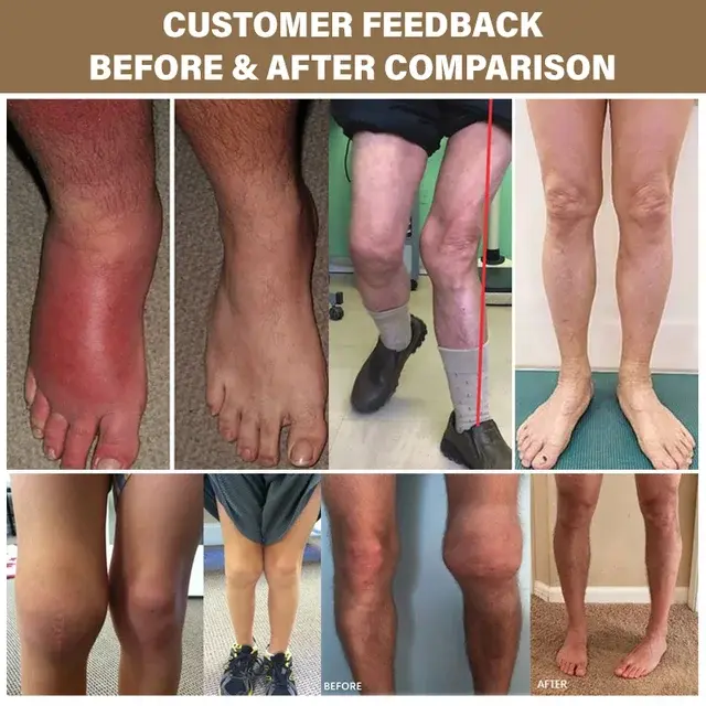 Natural Herbal Repair Cream