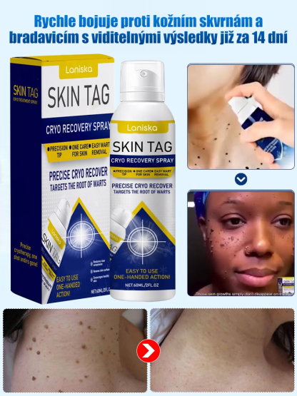 Sprej na ošetření bradavic