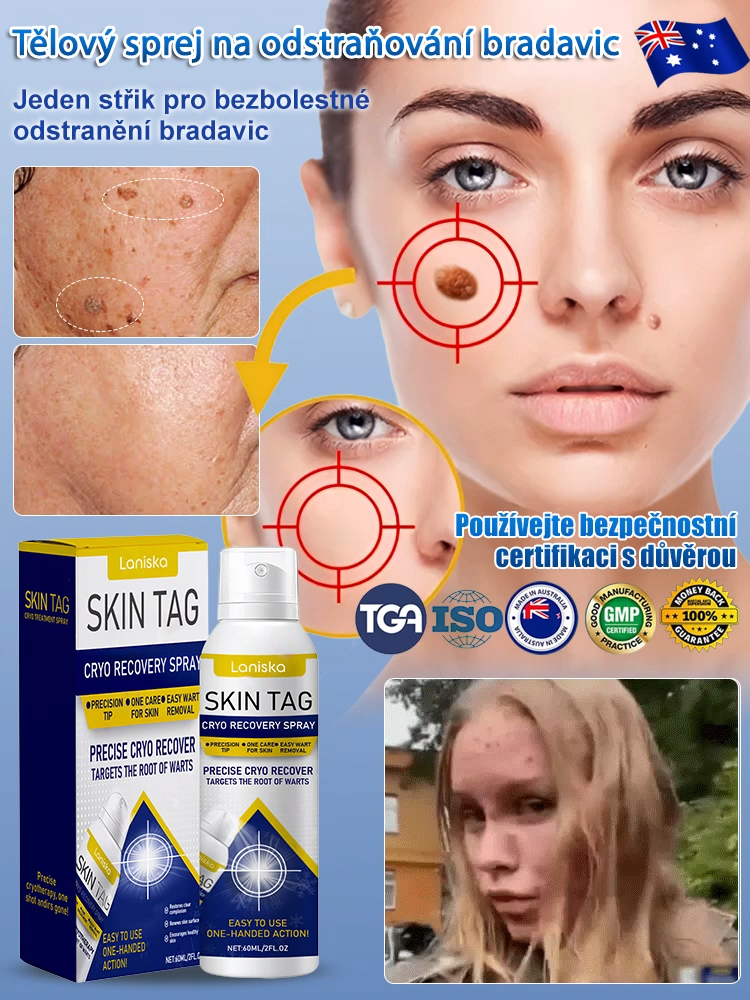 Sprej na ošetření bradavic