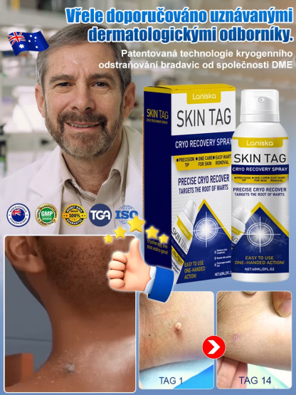 Sprej na ošetření bradavic