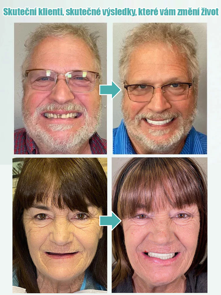 Přestaňte utrácet tisíce u zubaře! Získejte doma pohodlné zubní protézy na míru během několika sekund.