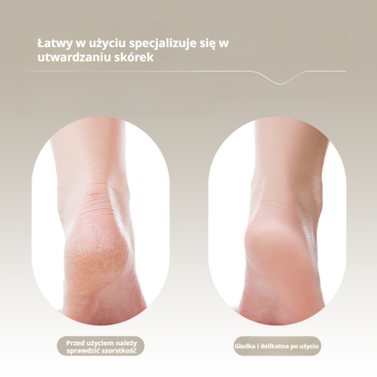 Dwufunkcyjny domowy pilnik do stóp i myjka do stóp