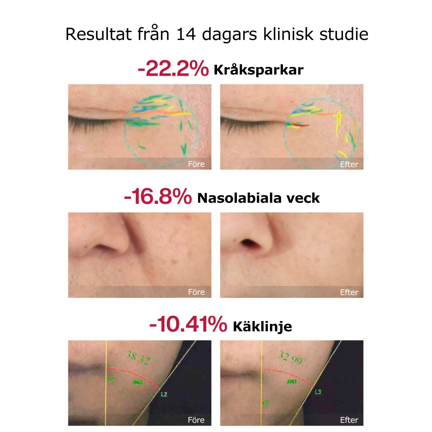 Vellera™ S1 Pro Ansiktsapparat – Fastare, slätare och mer elastisk hud