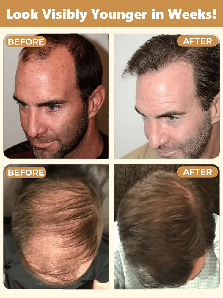 Herbal Essence Nourishing Repair Shampoo promotes visibly thicker, fuller hair with reduced shedding—see healthy growth transformation in 60 days.