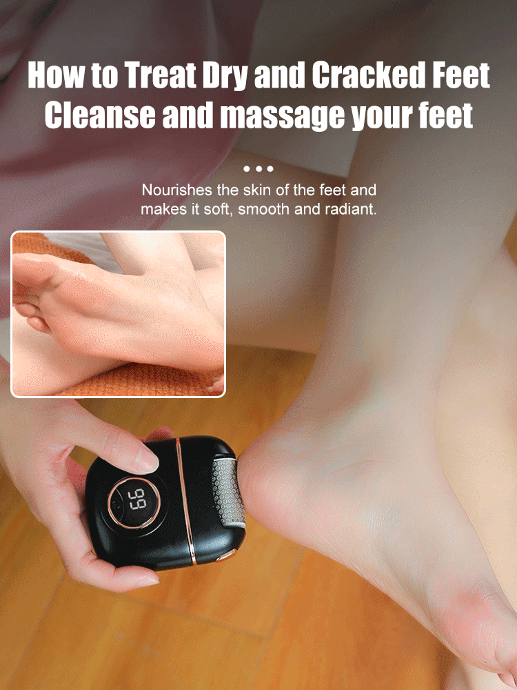 Latest research and development from German research institutes！Remove 10-year-old calluses in 10 seconds without damaging your skin!