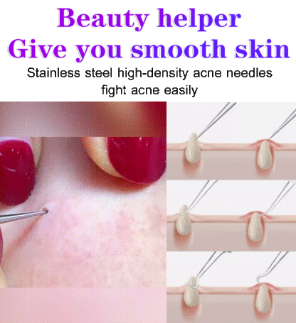 ❣️Recommended by beauticians， Stainless Steel Comedo Extractor for Professional Facial Care，🌪️High-precision, easy acne removal, no stinging sensation