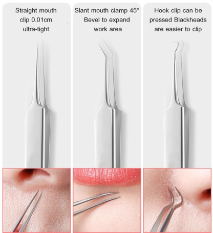 ❣️Recommended by beauticians， Stainless Steel Comedo Extractor for Professional Facial Care，🌪️High-precision, easy acne removal, no stinging sensation