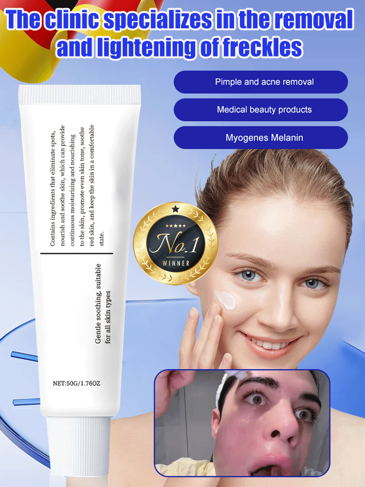 7 Days to Fade Dark Spots, Acne Scars & Sun Spots! German Medical-Grade Spot-Removing Cream!