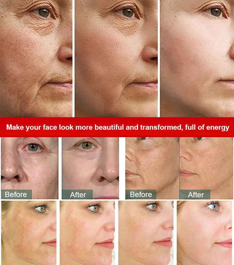 Apply once before bed, and your skin will look ten years younger!