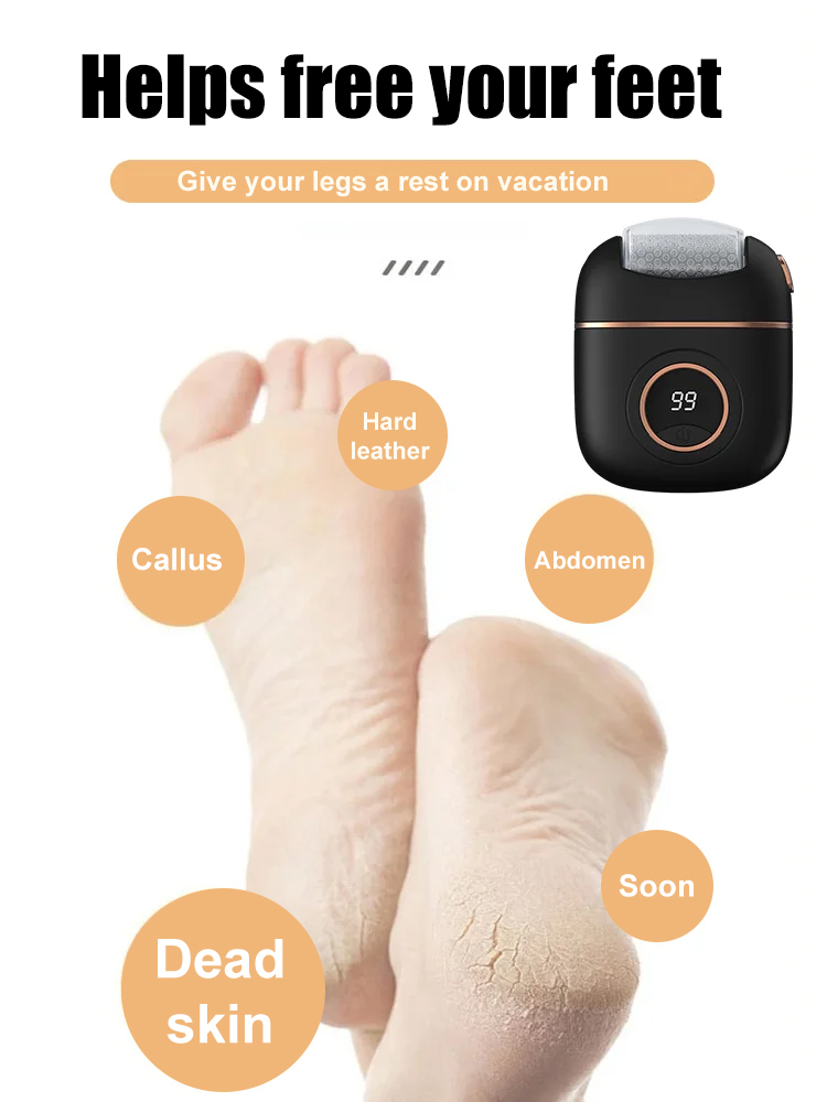 Latest research and development from German research institutes！Remove 10-year-old calluses in 10 seconds without damaging your skin!