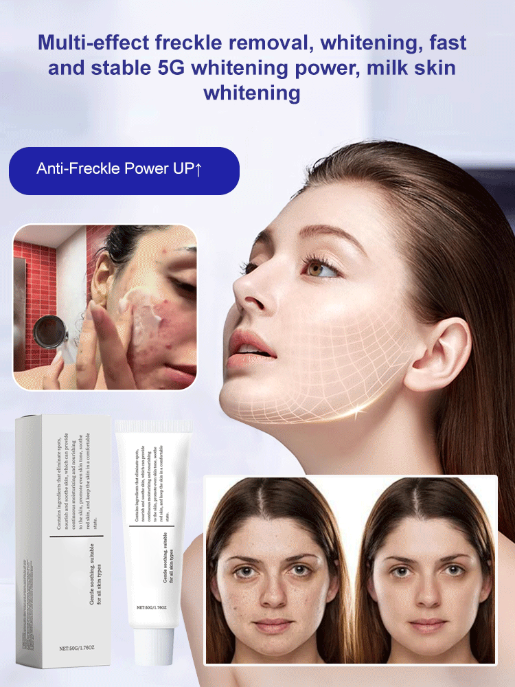 7 Days to Fade Dark Spots, Acne Scars & Sun Spots! German Medical-Grade Spot-Removing Cream!