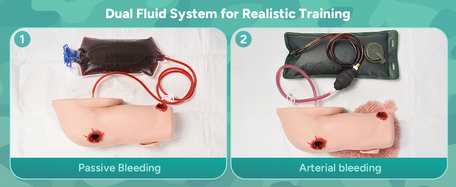 Dual Fluid System for Passive Bleeding or Arterial Bleeding