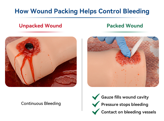 Diagram Explaining How Wound Packing Helps Control Bleeding