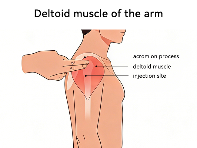 The Anatomy of Deltoid Muscle Injection Site