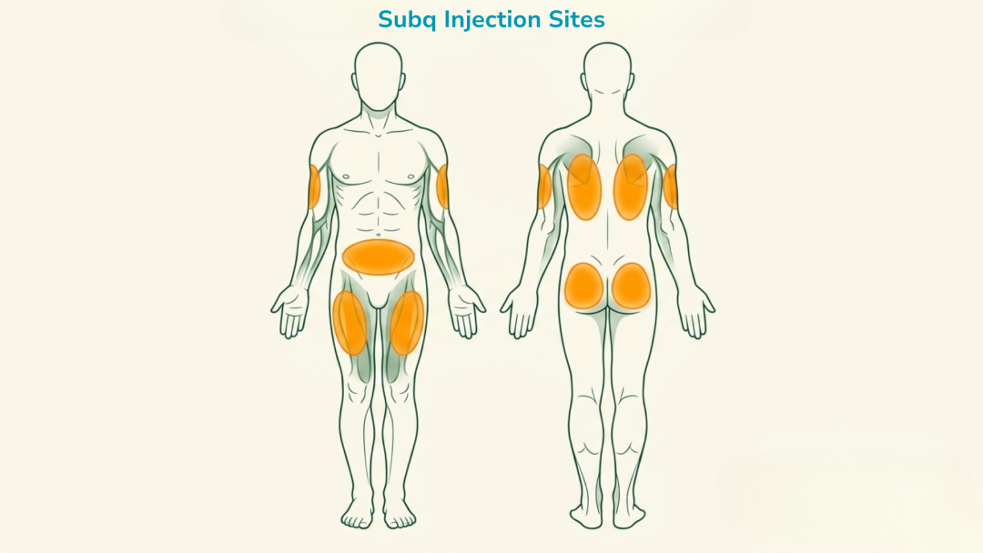 Subq Injection Rotation Deltoid Muscle Site for Injection: A Complete Guide – Skillssist