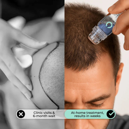 Zentra Hair Regrowth Micro-Infusion System