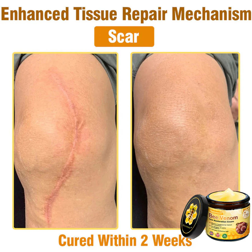 Bee Venom Skin Restoration Cream 