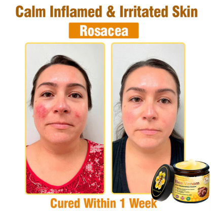 Bee Venom Skin Restoration Cream 
