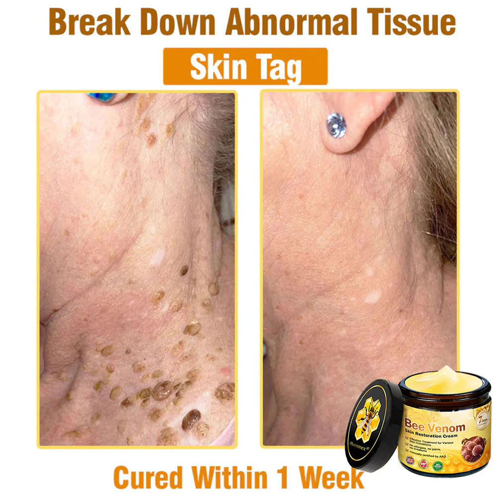 Bee Venom Skin Restoration Cream 