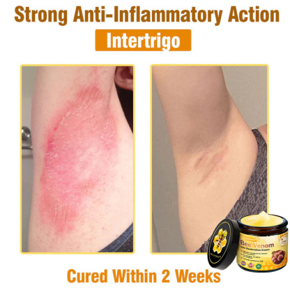 Bee Venom Skin Restoration Cream 