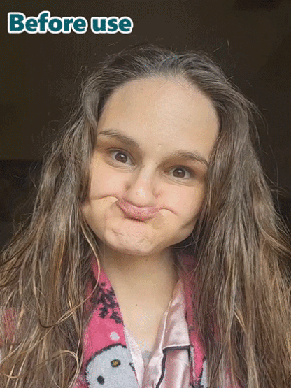 [FDA Certified] Perfectly Fitting Custom-Made Dentures