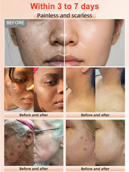 Orange Enzyme Gentle Exfoliating Gel