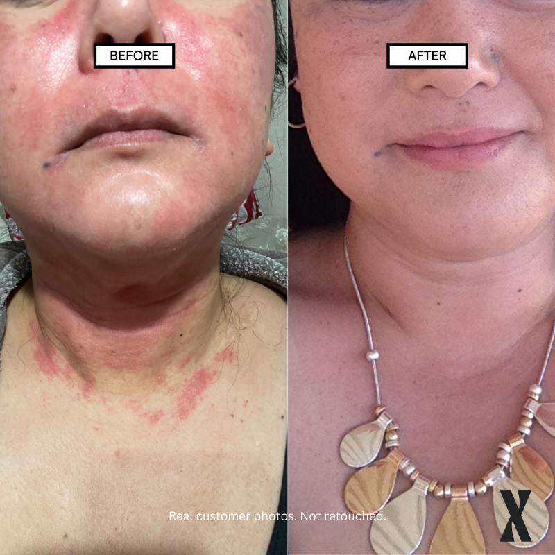 Moisture Boost Face & Body Cream