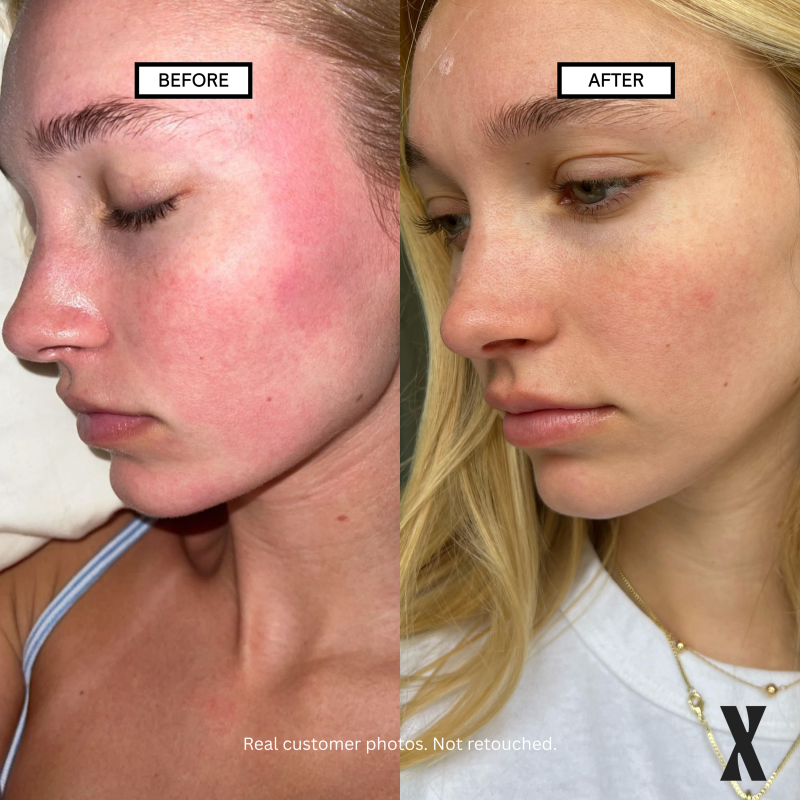 Blank Slate Micellar Water