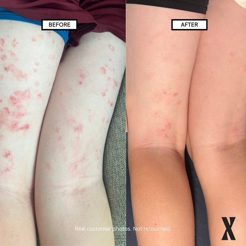 Barrier Basics Bundle