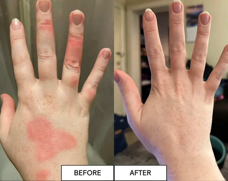 Barrier Basics Bundle