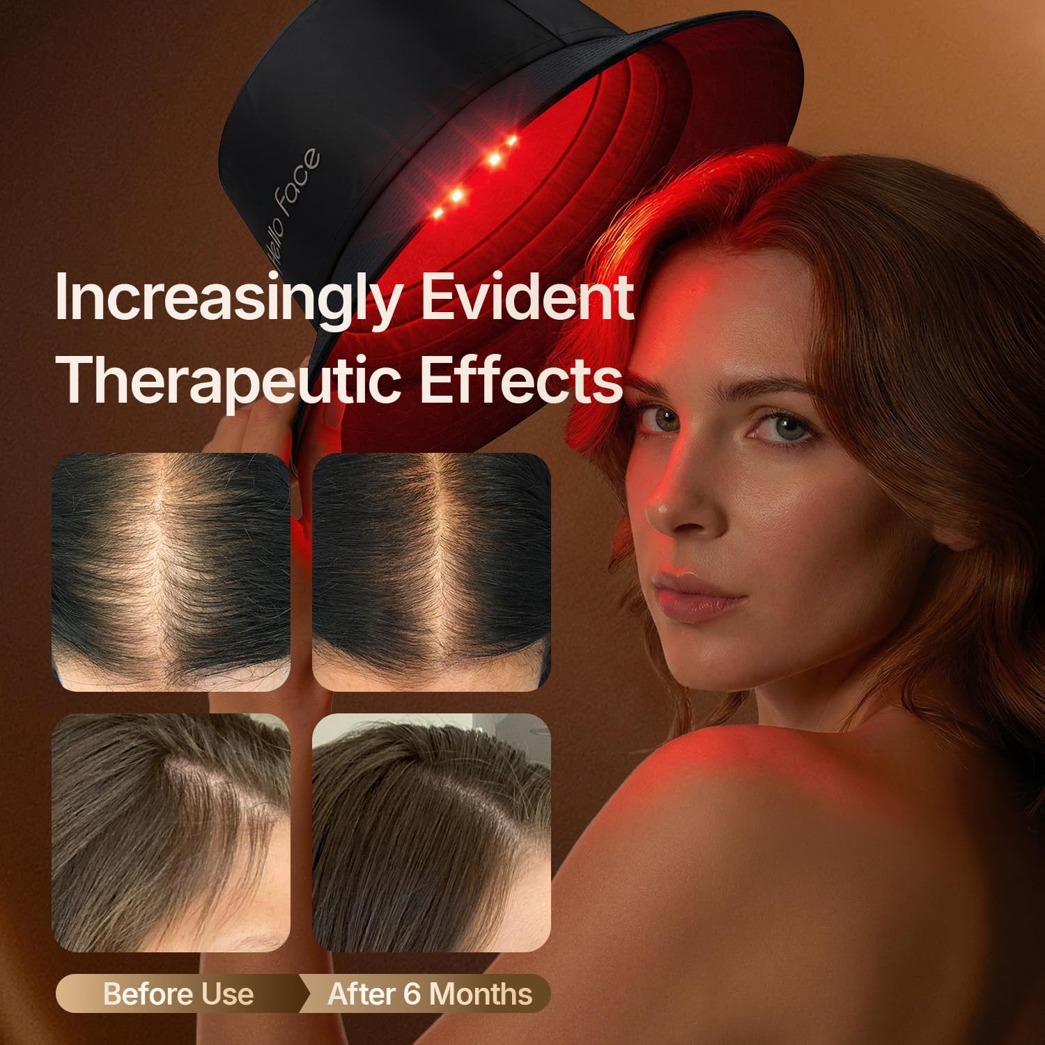 Red Light Therapy Hair Growth Cap