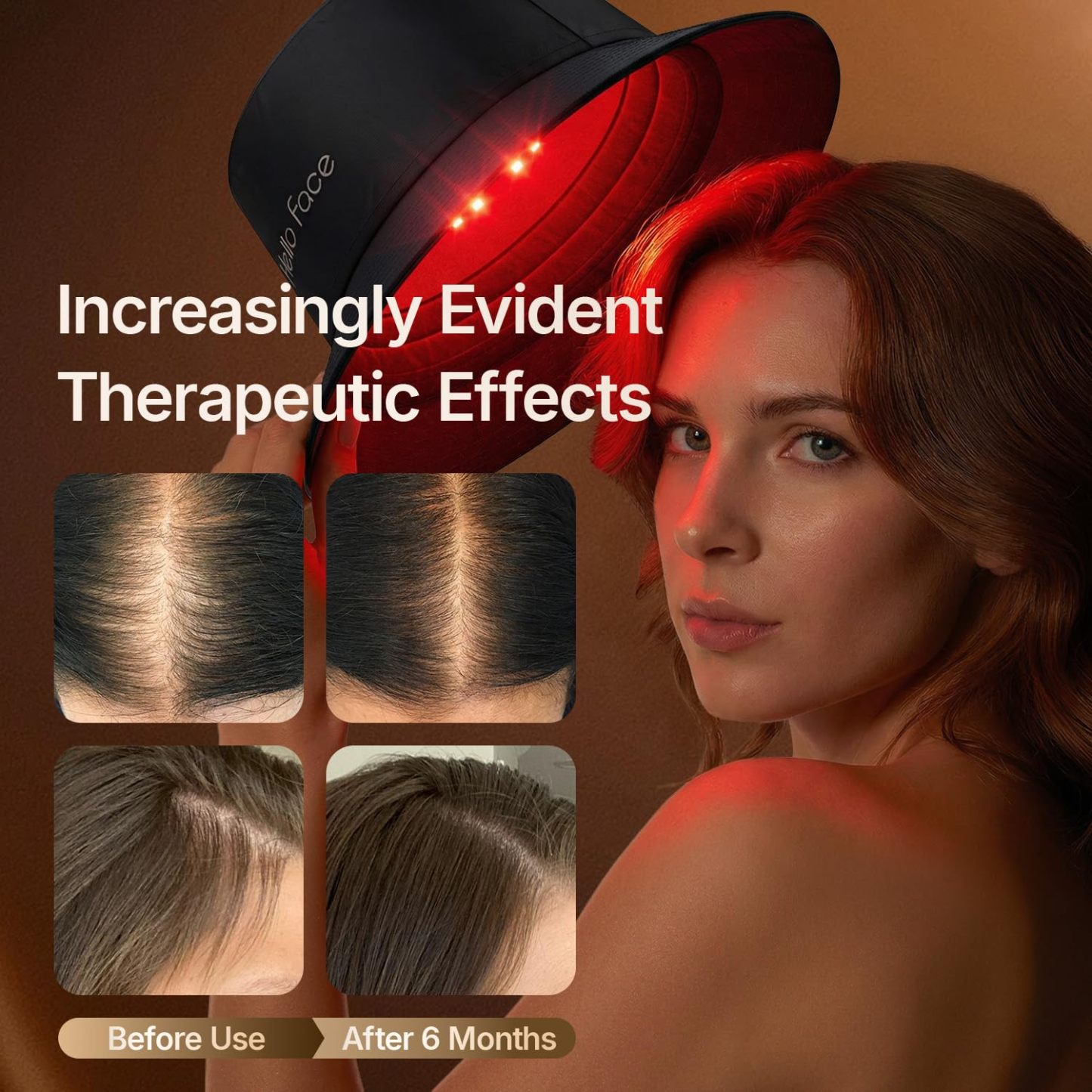 Red Light Therapy Hair Growth Cap