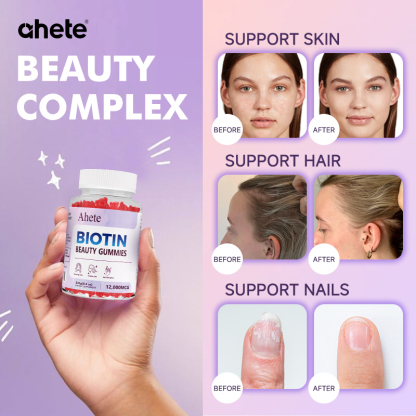 Ahete Biotin Gummies - Scalp Hair Follicles Are Healthy and Circulating, Hormonal Balance, Contains A Variety of Biotin and Vitamins | Grape Flavour, 60 Capsules, 30 Days
