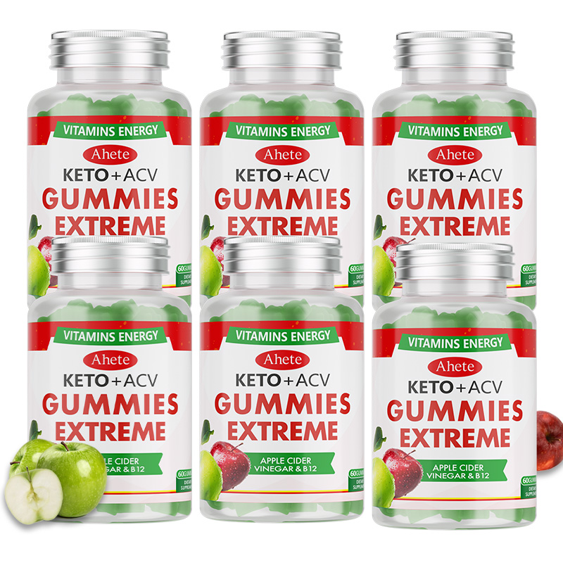 Ahete Apple Cider Vinegar Gummies, Natural Apple Cider Vinegar, Supplement A Large Amount Of Vitamins And Minerals, Digestive Support, High-quality Dietary Supplements