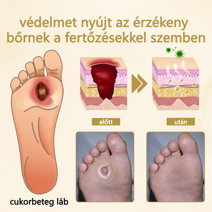 Cvreoz® méhméreg gyógyító spray a sebek gyógyulására és regenerálására a kezeken és a lábakon🩹