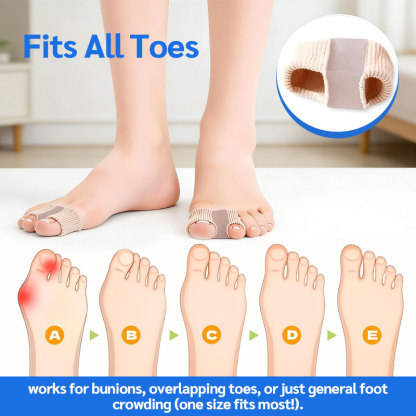 Toe Separator & Bunion Corrector 🦶