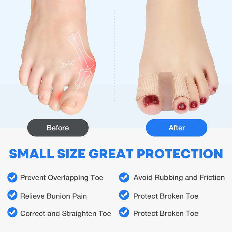 Toe Separator & Bunion Corrector 🦶