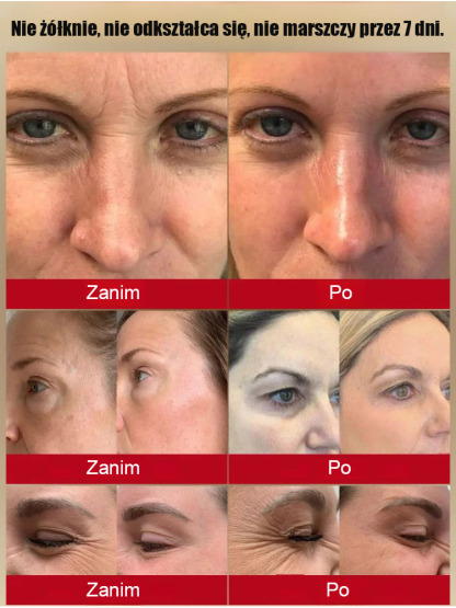 Anty-aging peptide anty-wrinkle moisturing cream