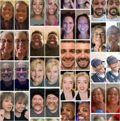 Zestaw kosmetycznych protez zębowych