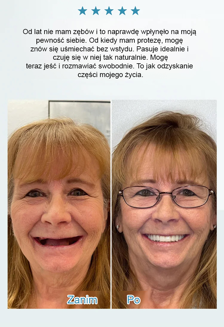 Zestaw kosmetycznych protez zębowych