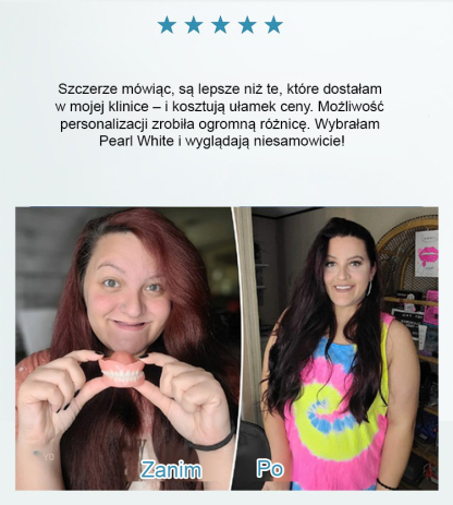 Zestaw kosmetycznych protez zębowych