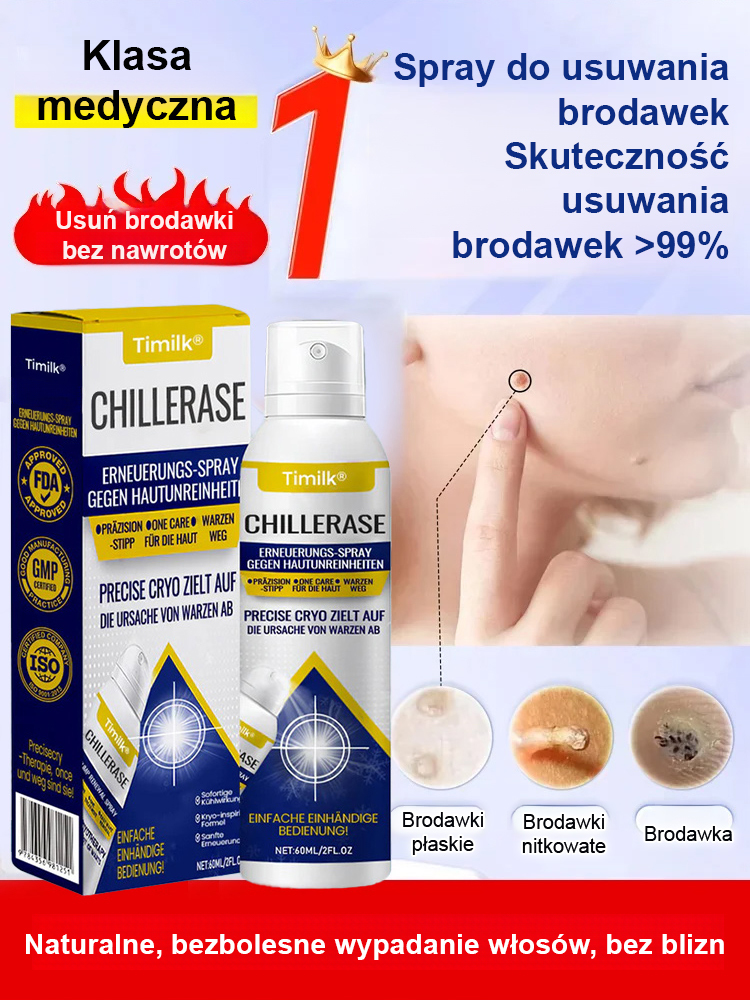 【Usuwanie kurzajek bez nawrotów】Spray do pielęgnacji skóry do użytku zewnętrznego