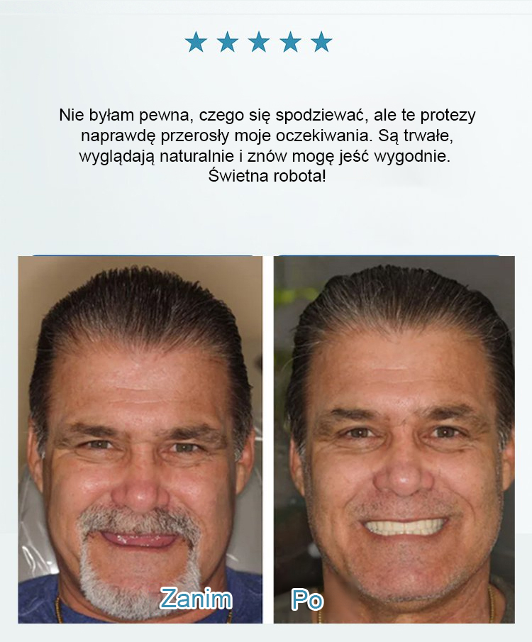 Zestaw kosmetycznych protez zębowych