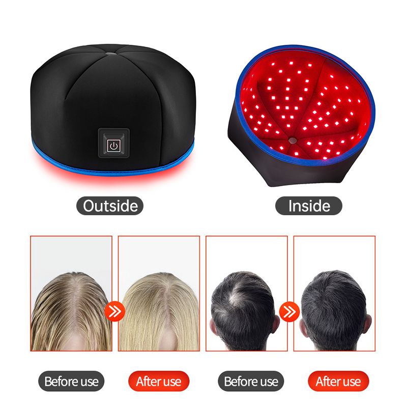Led Hair Regrow Machine Home Use Red HatInfrared Hat Laser Caps Hairloss Cap for Hair Regrowth for Women