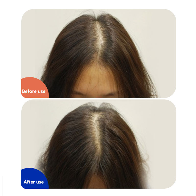 Led Hair Regrow Machine Home Use Red HatInfrared Hat Laser Caps Hairloss Cap for Hair Regrowth for Women