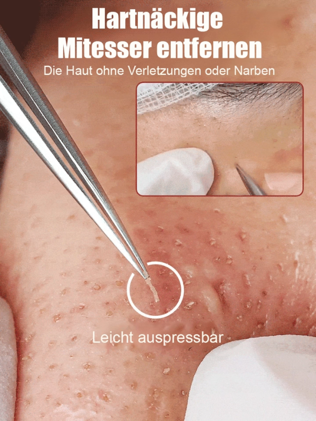 Deutsche Präzisions-Schönheitssalon-Zellklemme