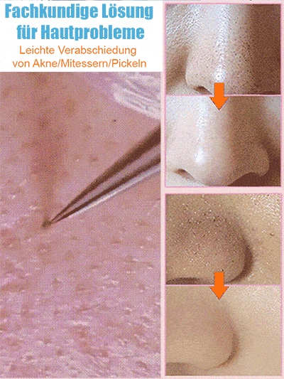 Deutsche Präzisions-Schönheitssalon-Zellklemme