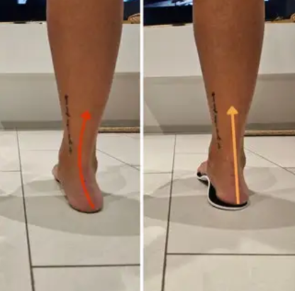 Perfect Arch Support Insoles – Pain Relief & All-Day Comfort