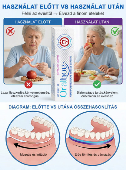 ✨ÉlelmiszeripariHőre Lágyuló Fogsor Rögzítő - 5 perc a stabil fogsorért