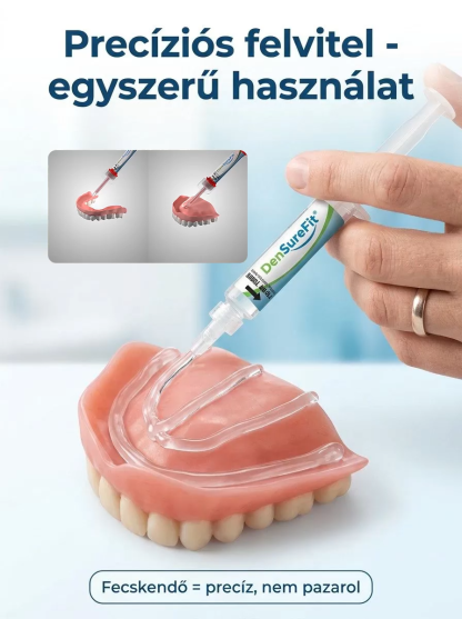 Eleged van a mozgó műfogsorból és a ragacsos krémekből? Itt a megoldás! 🦷